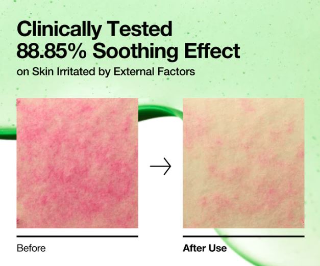 Anua Azelaic 10 Hyaluron Redness Soothing Pad