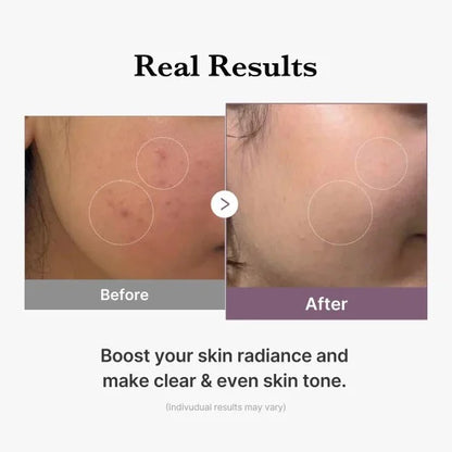 MEDICUBE PDRN Pink Glutathione Toner For Glowing Skin