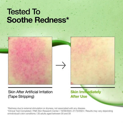 Anua - Azelaic Acid 10-Hyaluron Redness Soothing Serum.