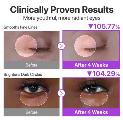Numbuzin No. 9+ NAD+ Retinol Volumetox Eye Cream.