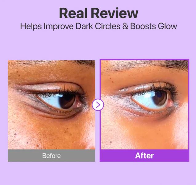 Numbuzin No. 9+ NAD+ Retinol Volumetox Eye Cream.