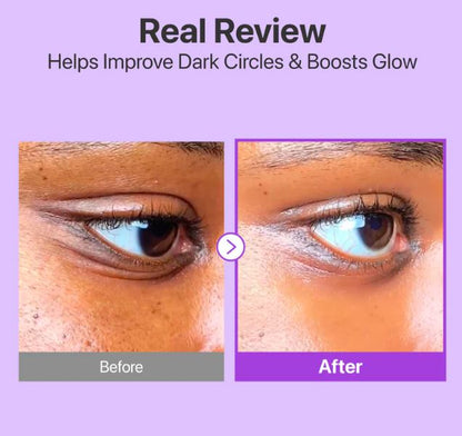 Numbuzin No. 9+ NAD+ Retinol Volumetox Eye Cream.